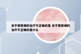 關(guān)于銀屑病的治療不正確的是 關(guān)于銀屑病的治療不正確的是什么