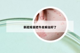 新冠疫苗把牛皮癬治好了