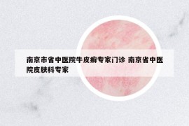 南京市省中醫(yī)院牛皮癬專家門診 南京省中醫(yī)院皮膚科專家