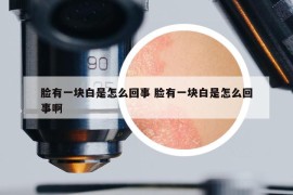 臉有一塊白是怎么回事 臉有一塊白是怎么回事啊