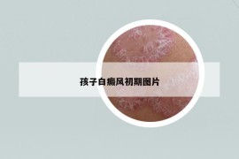 孩子白癜風(fēng)初期圖片