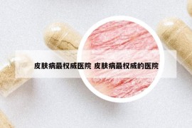 皮膚病最權(quán)威醫(yī)院 皮膚病最權(quán)威的醫(yī)院