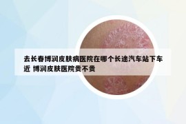 去長(zhǎng)春博潤(rùn)皮膚病醫(yī)院在哪個(gè)長(zhǎng)途汽車站下車近 博潤(rùn)皮膚醫(yī)院貴不貴