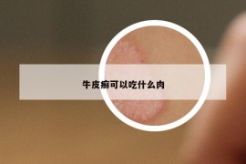 牛皮癬可以吃什么肉