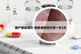 國(guó)產(chǎn)銀屑病針 銀屑病特效針劑一針2萬(wàn)