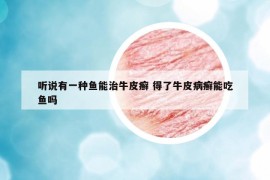 聽說有一種魚能治牛皮癬 得了牛皮病癬能吃魚嗎