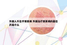 外國人不在乎銀屑病 外國治療銀屑病的最佳藥是什么