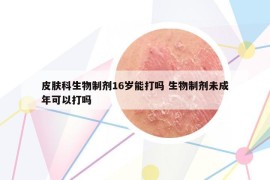 皮膚科生物制劑16歲能打嗎 生物制劑未成年可以打嗎