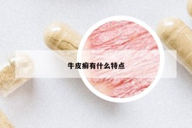 牛皮癬有什么特點(diǎn)