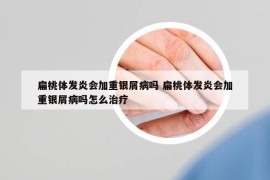 扁桃體發(fā)炎會加重銀屑病嗎 扁桃體發(fā)炎會加重銀屑病嗎怎么治療