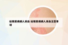 給銀屑病病人采血 給銀屑病病人采血注意事項