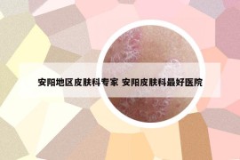 安陽地區(qū)皮膚科專家 安陽皮膚科最好醫(yī)院