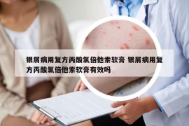 銀屑病用復(fù)方丙酸氯倍他索軟膏 銀屑病用復(fù)方丙酸氯倍他索軟膏有效嗎