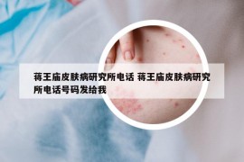 蔣王廟皮膚病研究所電話 蔣王廟皮膚病研究所電話號碼發(fā)給我