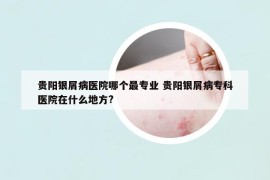貴陽(yáng)銀屑病醫(yī)院哪個(gè)最專(zhuān)業(yè) 貴陽(yáng)銀屑病專(zhuān)科醫(yī)院在什么地方?