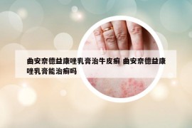 曲安奈德益康唑乳膏治牛皮癬 曲安奈德益康唑乳膏能治癬嗎