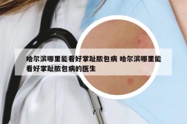 哈爾濱哪里能看好掌趾膿包病 哈爾濱哪里能看好掌趾膿包病的醫(yī)生
