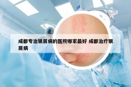 成都專(zhuān)治銀屑病的醫(yī)院哪家最好 成都治療銀屑病
