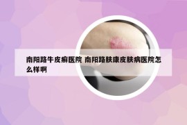 南陽路牛皮癬醫(yī)院 南陽路膚康皮膚病醫(yī)院怎么樣啊