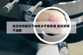 南京鼓樓醫(yī)院干細胞治療銀屑病 南京鼓樓 干細胞