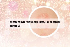 牛皮廨在治療過程中老是出現(xiàn)小點 牛皮廨復發(fā)的原因