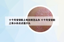 十個月寶寶臉上有白斑怎么辦 十個月寶寶臉上有小白點點是什么