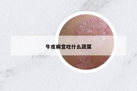 牛皮癬宜吃什么蔬菜