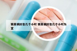 銀屑病封包幾個(gè)小時(shí) 銀屑病封包幾個(gè)小時(shí)為宜