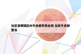 社區(qū)清理轄區(qū)內(nèi)牛皮癬勞務(wù)合同 社區(qū)牛皮鮮整治