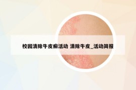 校園清除牛皮癬活動 清除牛皮_活動簡報