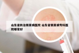 山東省防治銀屑病醫(yī)院 山東省銀屑病?？漆t(yī)院哪家好