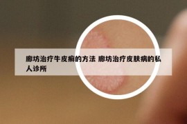 廊坊治療牛皮癬的方法 廊坊治療皮膚病的私人診所