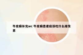 牛皮癬補(bǔ)充wc 牛皮癬患者應(yīng)該吃什么維生素