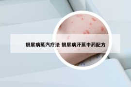 銀屑病蒸汽療法 銀屑病汗蒸中藥配方