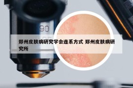 鄭州皮膚病研究學(xué)會連系方式 鄭州皮膚病研究所