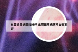 東莞銀屑病醫(yī)院排行 東莞銀屑病醫(yī)院去哪家好