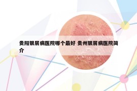 貴陽銀屑病醫(yī)院哪個(gè)最好 貴州銀屑病醫(yī)院簡介