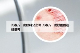 長(zhǎng)春八一皮膚科公眾號(hào) 長(zhǎng)春八一皮膚醫(yī)院在線咨詢