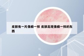 皮膚有一片像癬一樣 皮膚出現(xiàn)像癬一樣的東西
