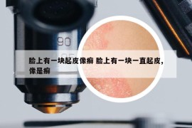臉上有一塊起皮像癬 臉上有一塊一直起皮,像是癬