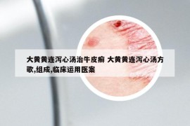 大黃黃連瀉心湯治牛皮癬 大黃黃連瀉心湯方歌,組成,臨床運用醫(yī)案
