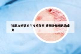 豬膽加明礬對牛皮癬作用 豬膽汁和明礬治皮炎