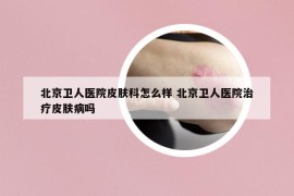 北京衛(wèi)人醫(yī)院皮膚科怎么樣 北京衛(wèi)人醫(yī)院治療皮膚病嗎