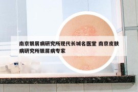 南京銀屑病研究所現(xiàn)代長(zhǎng)城名醫(yī)堂 南京皮膚病研究所銀屑病專家