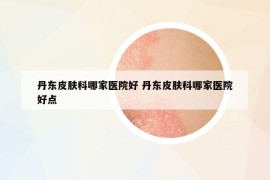 丹東皮膚科哪家醫(yī)院好 丹東皮膚科哪家醫(yī)院好點(diǎn)