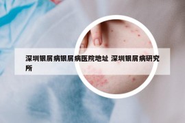 深圳銀屑病銀屑病醫(yī)院地址 深圳銀屑病研究所