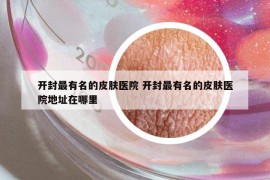 開封最有名的皮膚醫(yī)院 開封最有名的皮膚醫(yī)院地址在哪里