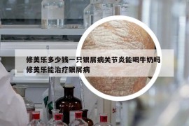 修美樂(lè)多少錢(qián)一只銀屑病關(guān)節(jié)炎能喝牛奶嗎 修美樂(lè)能治療銀屑病