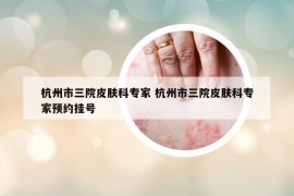 杭州市三院皮膚科專家 杭州市三院皮膚科專家預(yù)約掛號(hào)