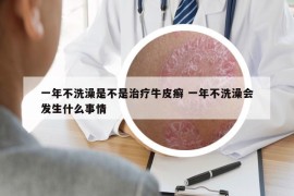 一年不洗澡是不是治療牛皮癬 一年不洗澡會(huì)發(fā)生什么事情